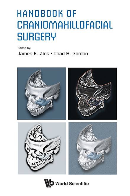 Handbook Of Craniomaxillofacial Surgery Handbook Of Craniomaxillofacial Surgery