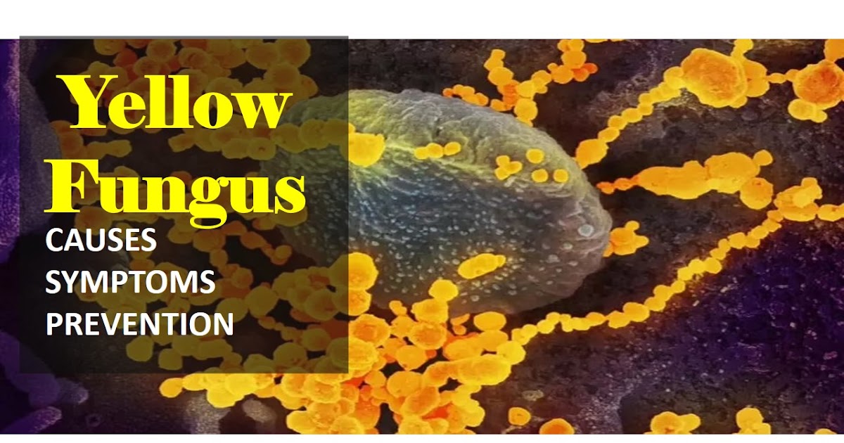 Yellow Fungus Causes, Symptom and its prevention