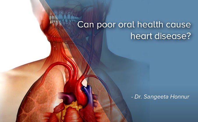 PERIODONTAL DISEASES: Can poor oral health cause heart disease? - Dr. Sangeeta Honnur