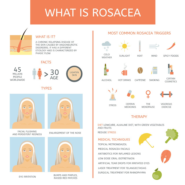 Symptons and treatments for Rosacea By Barbies Beauty Bits