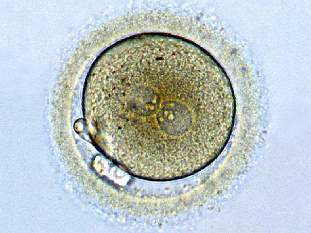 एक संसेचित ( fertilized ) अंड कोशिका कैसे सम्पूर्ण शिशु बनती है ? How does a fertilized egg make a complete baby?