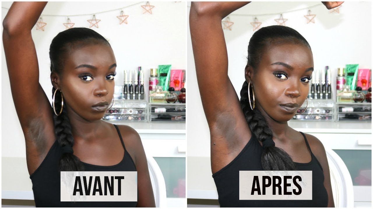 Dites adieu aux taches sombres avec cette recette d