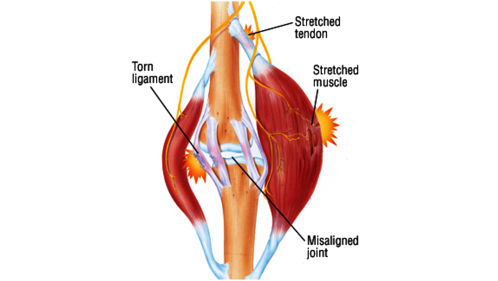 Kết quả hình ảnh cho cặp cơ đối kháng