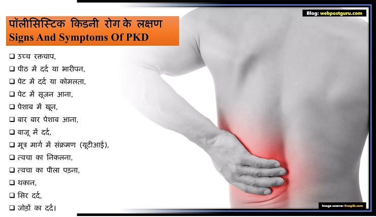 पॉलीसिस्टिक गुर्दा रोग, Symptoms of Polycystic kidney disease in Hindi