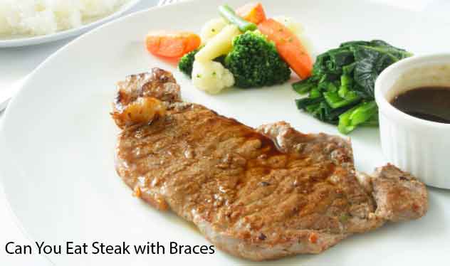 Everybody Need To Know Can You Eat Steak With Braces-World Quotes