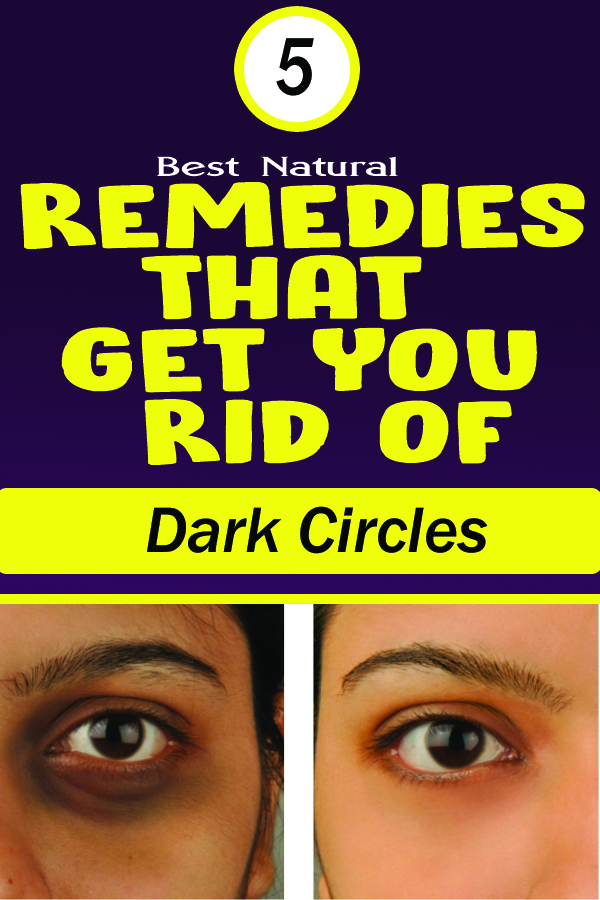 5 Best Natural Remedies That Get You Rid of Dark Circles