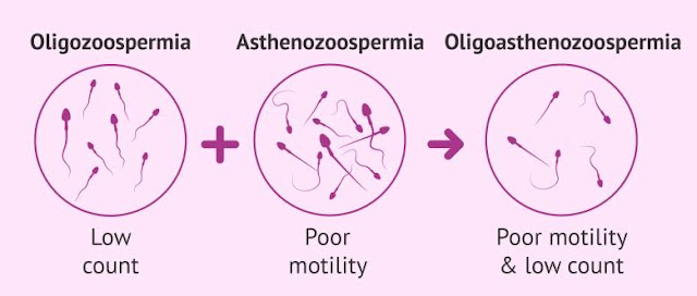 OligoAsthenozoospermia OligoAsthenozoospermia