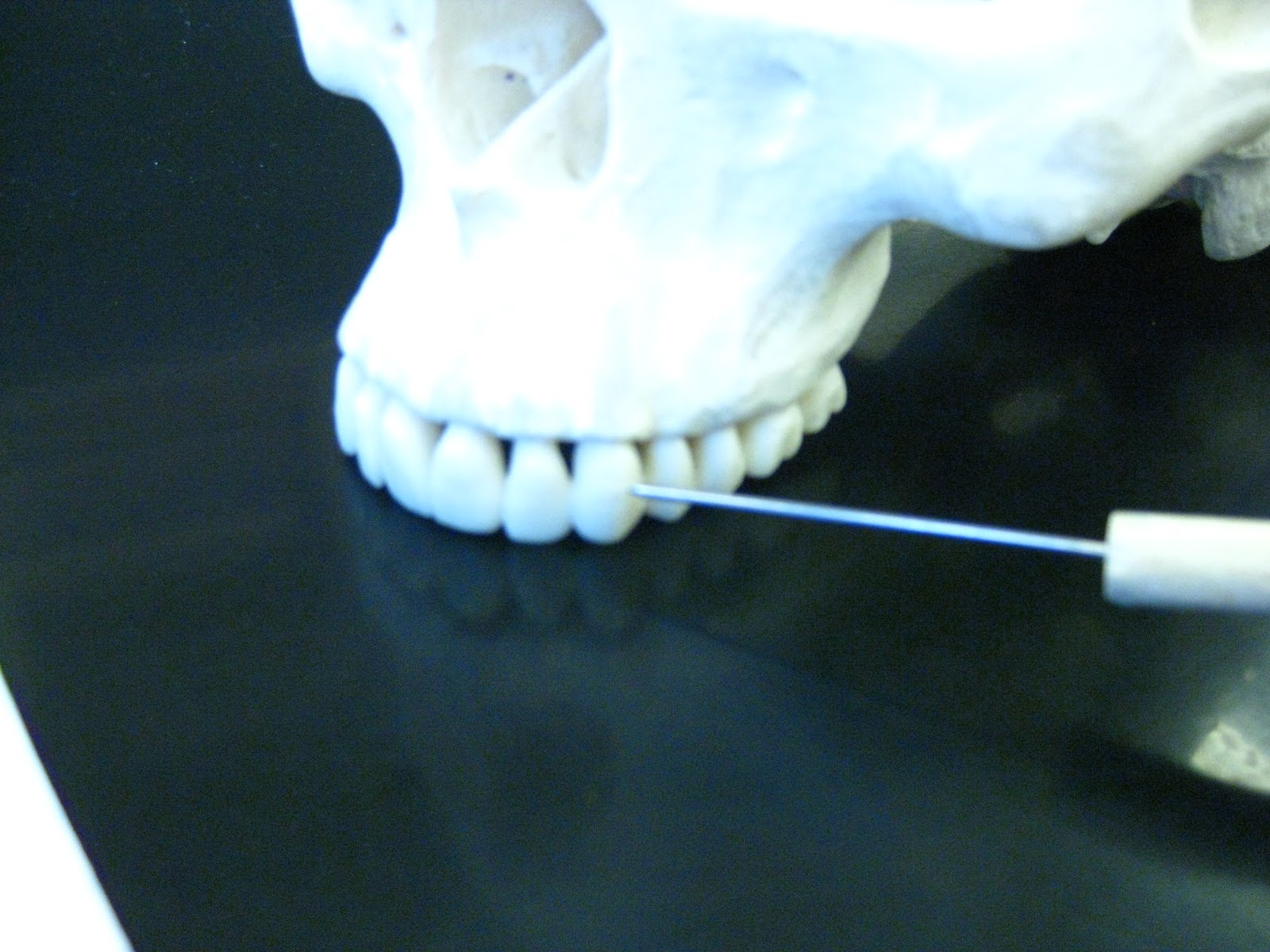 Boned: Human Skull - teeth