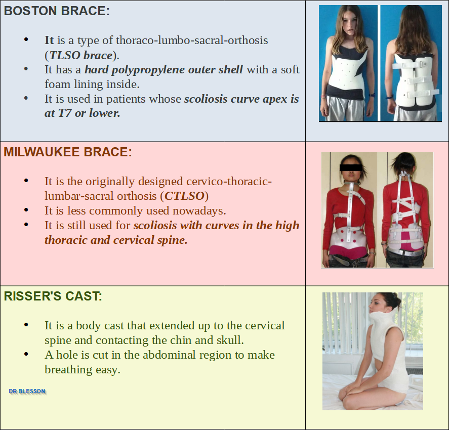 Difference between Boston Brace ,Milwakee Brace and Risser's Cast