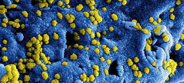 Фото Национального института США по инфекционным заболеваниям. Цифровое изображение коронавируса Ближневосточного респираторного синдрома (БВРС-КоВ)