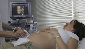 A woman having an ultrasound on her baby.