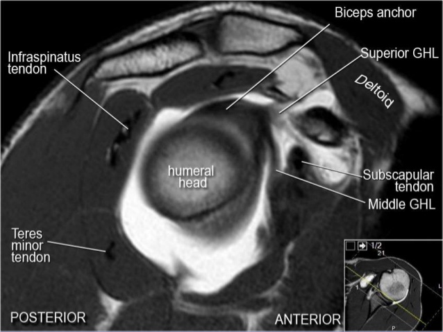 MRI Musculo-Skeletal Section: MRI anatomy of the shoulder (sagittal view).