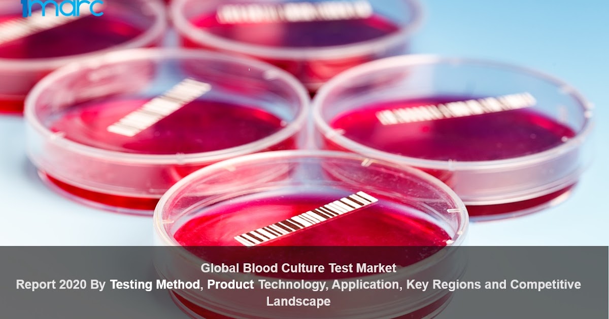 Global Blood Culture Test Market Overview 2020, Demand by Regions