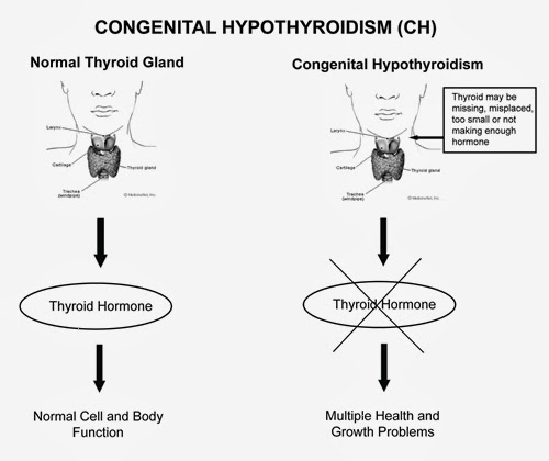 Medical Treatment Picturesfor Better Understanding Congenital
