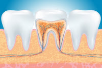 symptomes de mal de dents