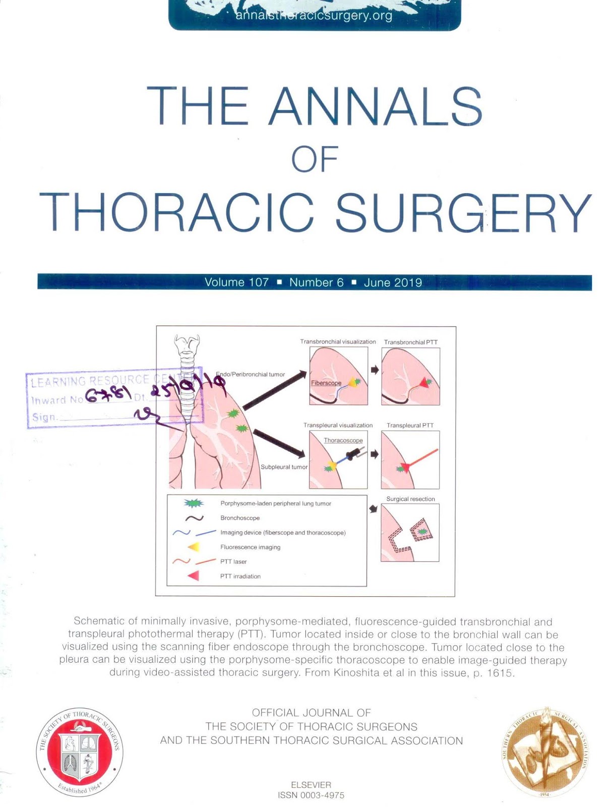 https://www.annalsthoracicsurgery.org/issue/S0003-4975(18)X0017-4