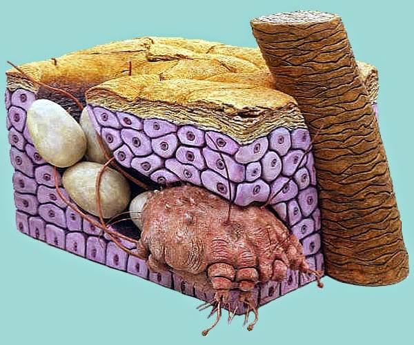 Obat Salep Anti Fungal Jamur Bakteri Scabies