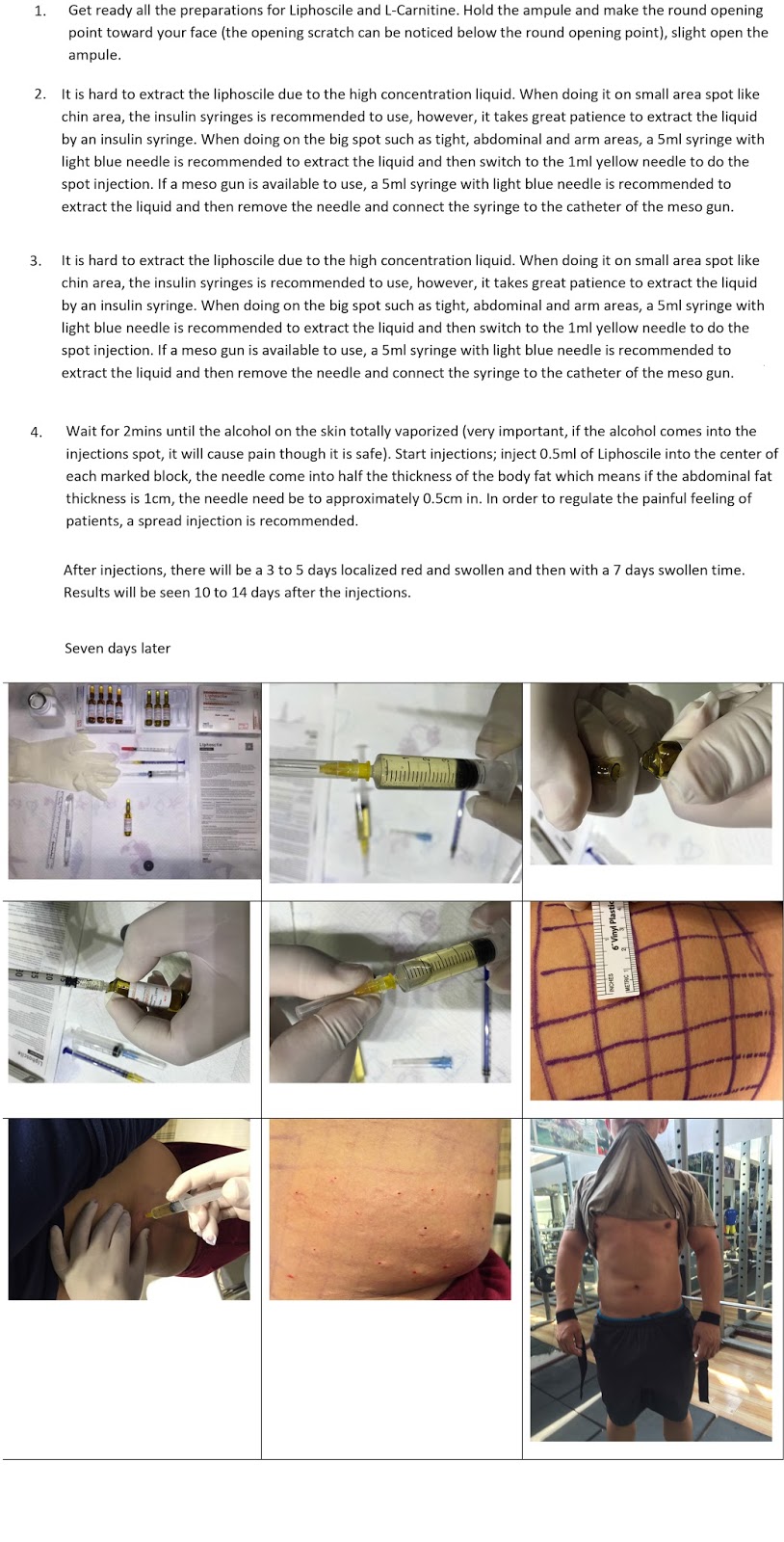 glutathione injection skin whitening how to use Lcarnitine injection?