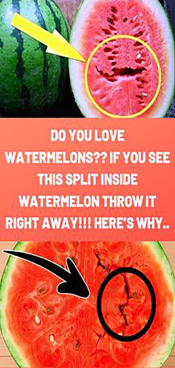 DO YOU LOVE WATERMELONS?? IF YOU SEE THIS SPLIT INSIDE WATERMELON THROW