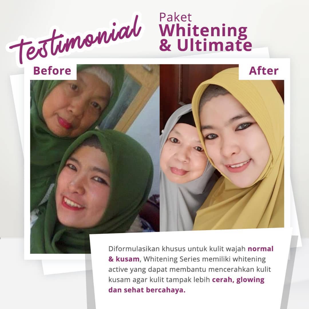 testimoni ms glow skin care