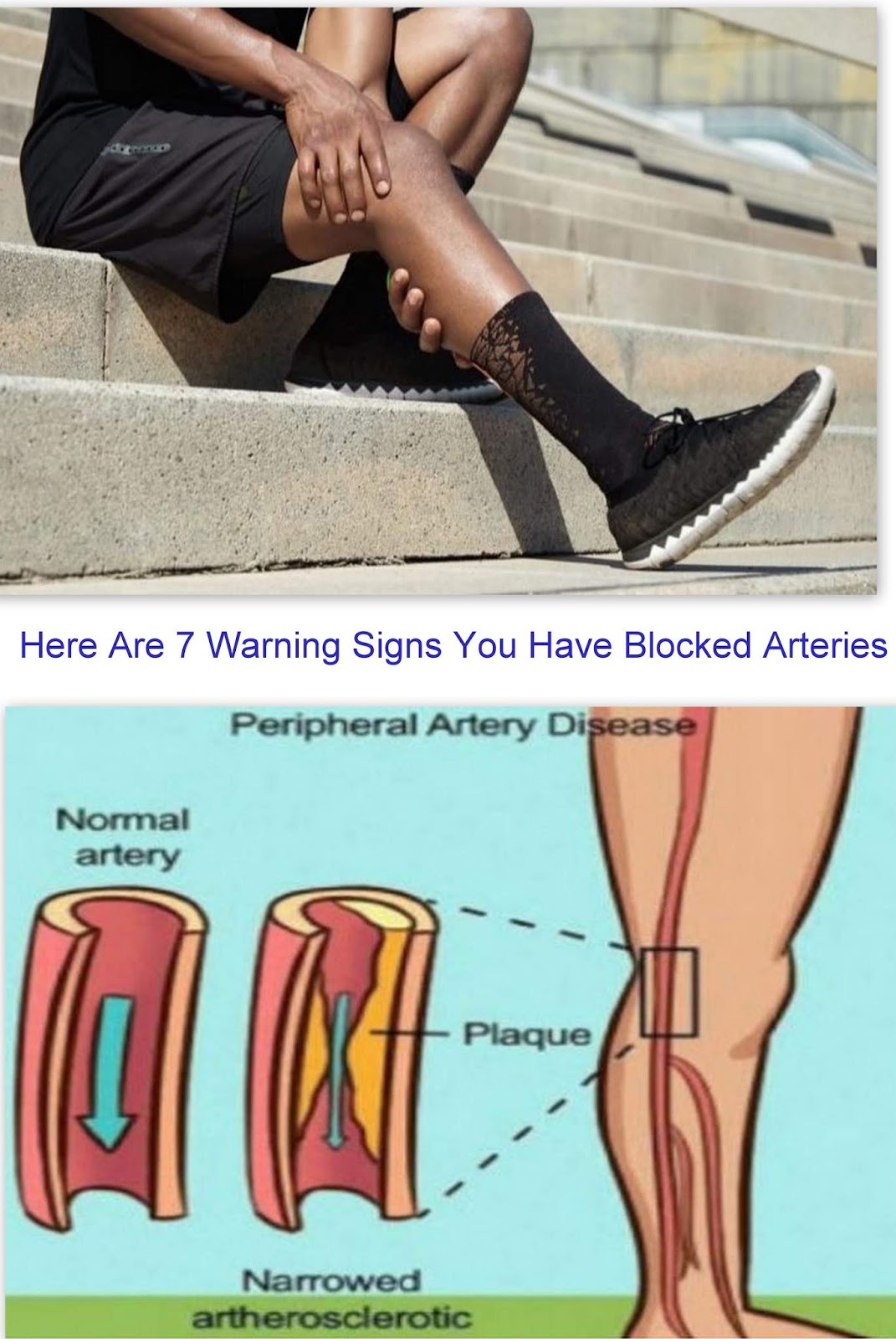 Here Are 7 Warning Signs You Have Blocked Arteries
