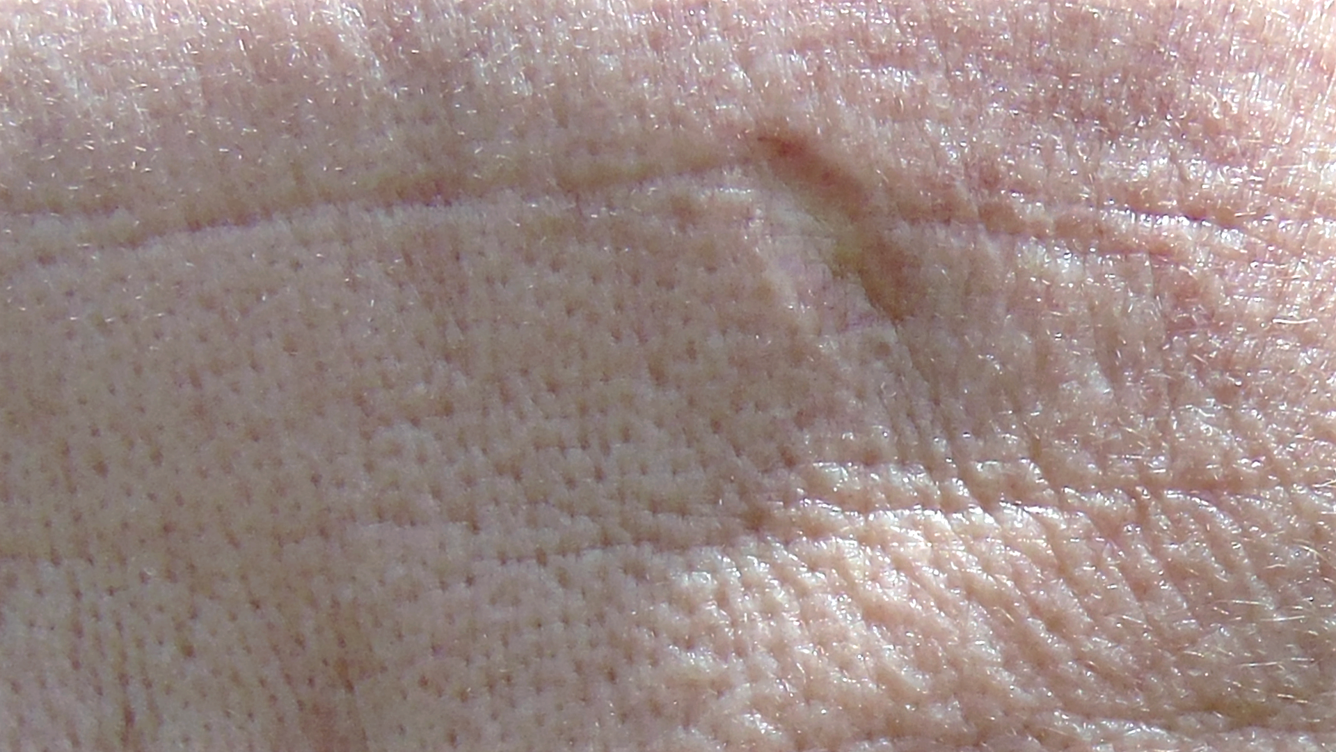 Lewa część mojego czoła