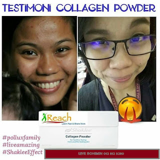 Testimoni Kolagen Shaklee