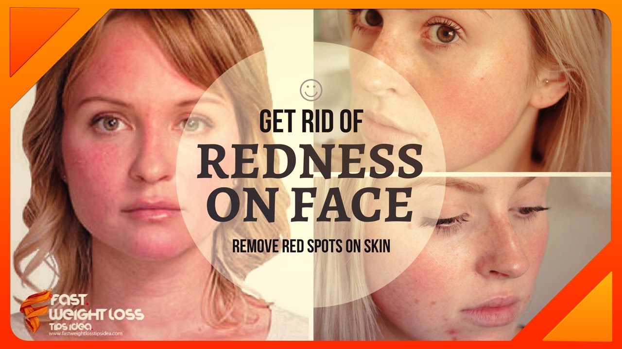 HOW TO REMOVE REDNESS FROM FACE Special Tricks