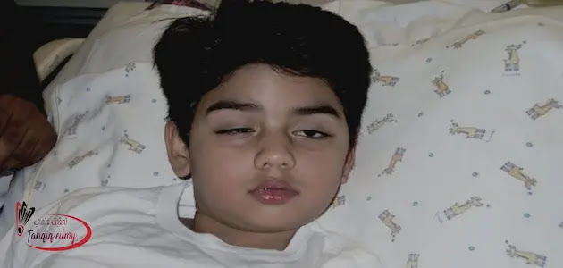 أعراض الوهن العضلي الشديد عند الرضع أعراض الوهن العضلي عند الرضع