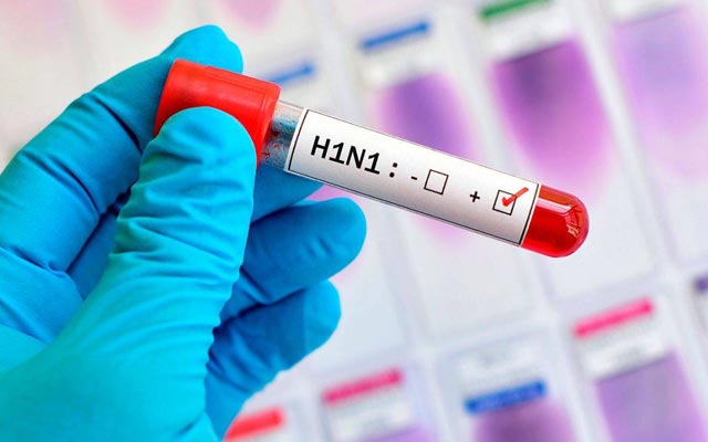 Bahia registra uma morte por H1N1 em Salvador