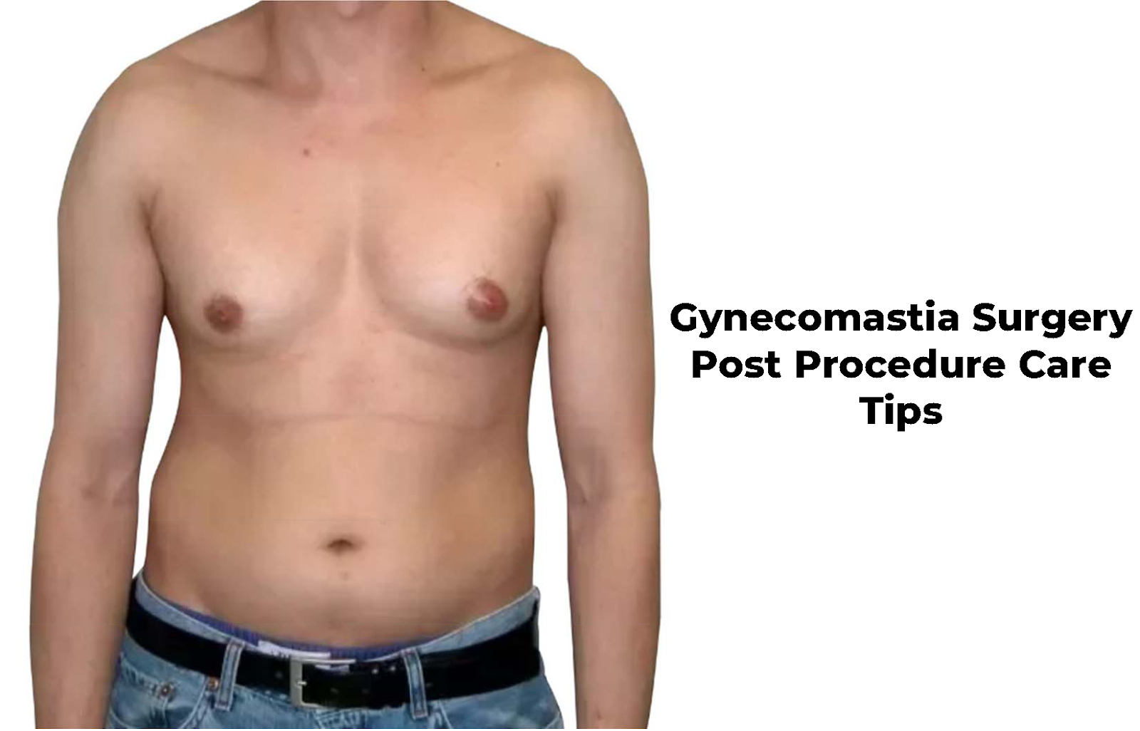 Gynecomastia Surgery Post Procedure Care Tips Gynecomastia Surgery Post Procedure Care Tips