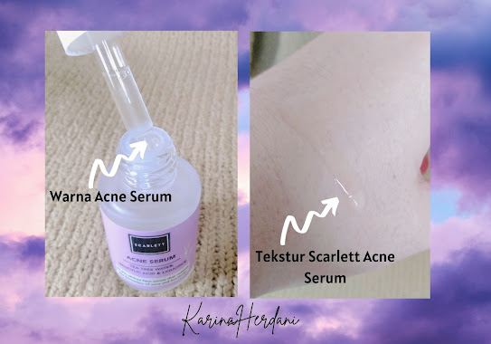 scarlett acne serum