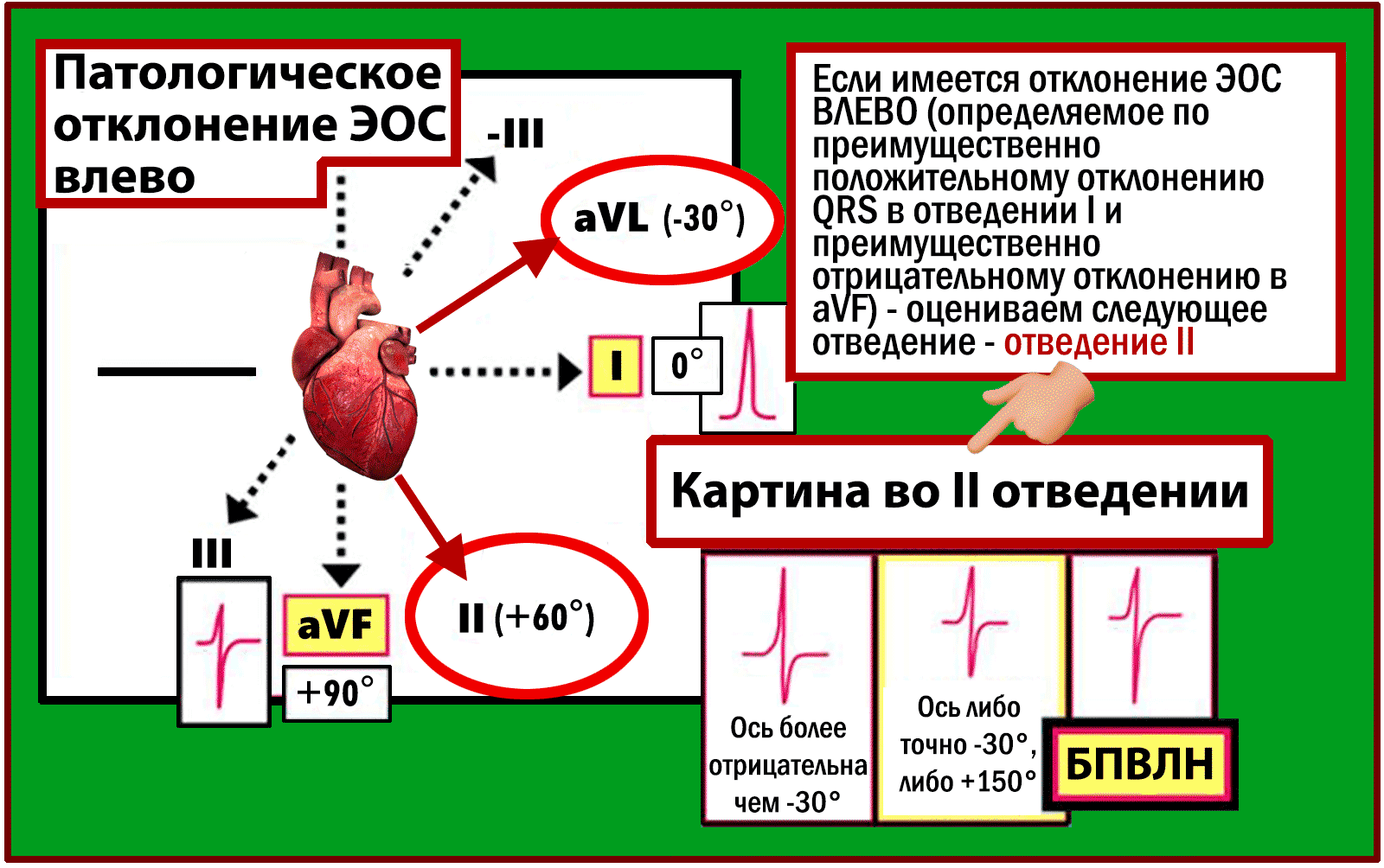 Блог по клинической электрофизиологии: Клинический разбор: Блокада