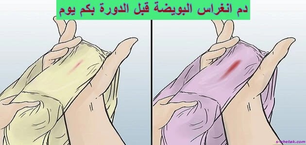 دم انغراس البويضة قبل الدورة بكم يوم