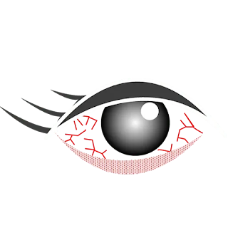 eyes causes Blepharitis treatment