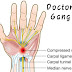 What is Carpal Tunnel Syndrome? | Doctors Gang