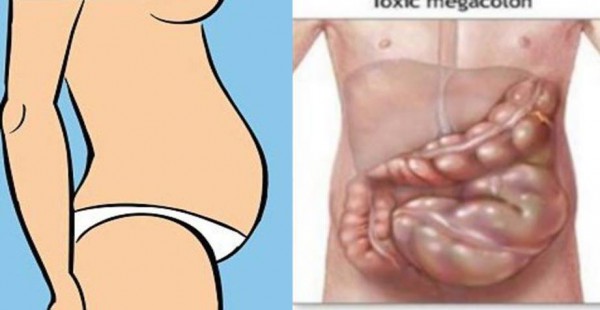 You Are Not Fat Your Stomach Is Bloated And Here Is How