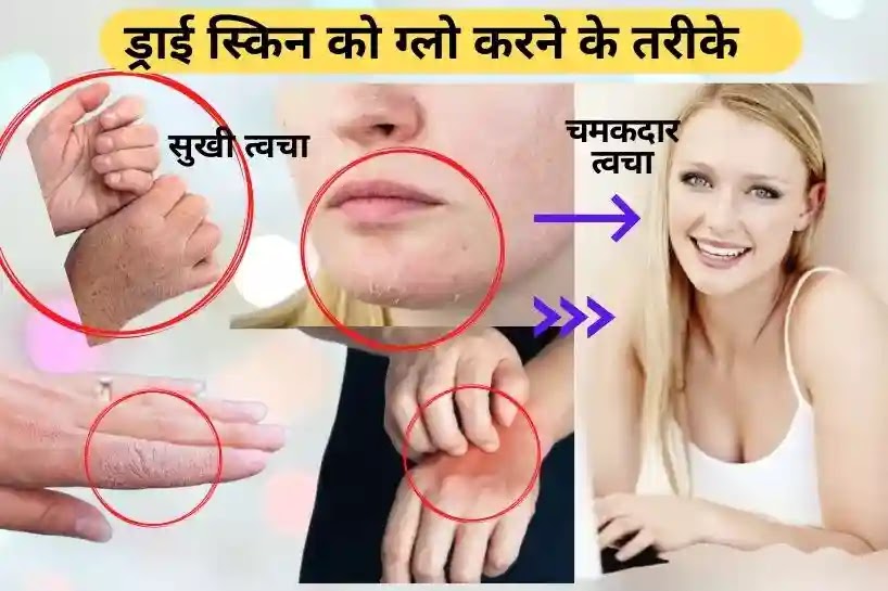 dry skin ko glow kaise kre, सुखी त्वचा को चमकदार बनाने के तरीके, how to glow dry skin in hindi
