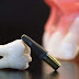  3 yếu tố đánh giá cấy ghép răng implant ở đâu tốt