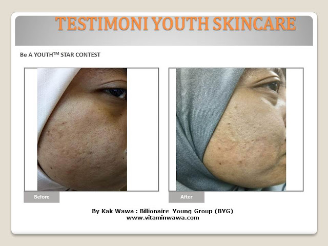 34 Testimoni Youth Skincare Shaklee Terbaru, Youth skincare shaklee, testimoni youth skincare shaklee, Youth Skincare Shaklee : Harga dan Review Pengguna Youth Shaklee, testimoni youth skincare shaklee, testimoni youth skincare shaklee 34 Testimoni Youth Skincare Shaklee Terbaru, Youth skincare shaklee, testimoni youth skincare shaklee, Youth Skincare Shaklee : Harga dan Review Pengguna Youth Shaklee, testimoni youth skincare shaklee, testimoni youth skincare shaklee