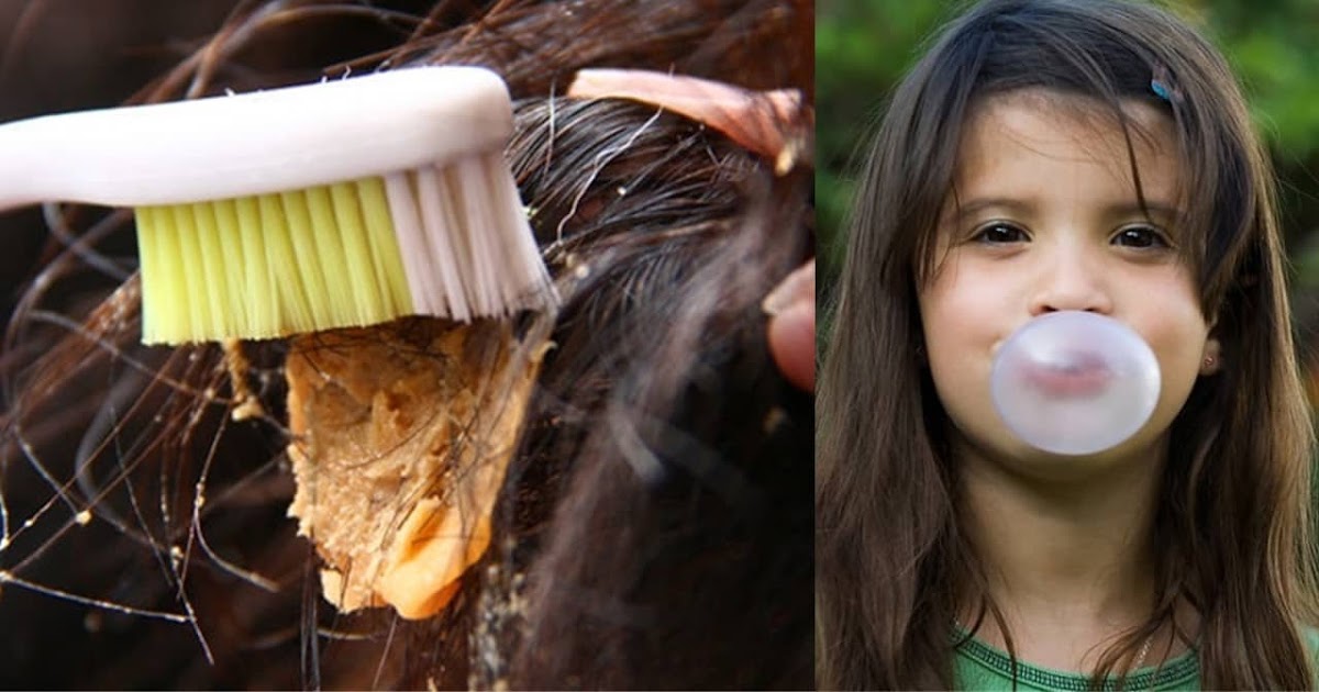 Cómo sacar chicle del cabello Cómo sacar chicle del cabello