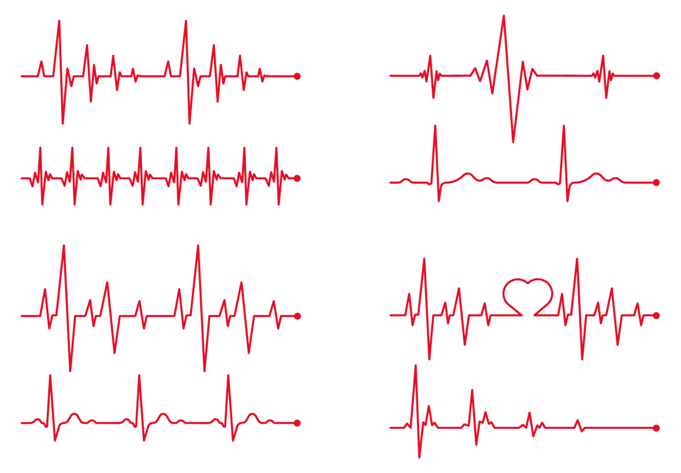кардиограмма сердца. кардиограмма сердца. линия пульса. кардиограмма вектор. экг на белом фоне.
