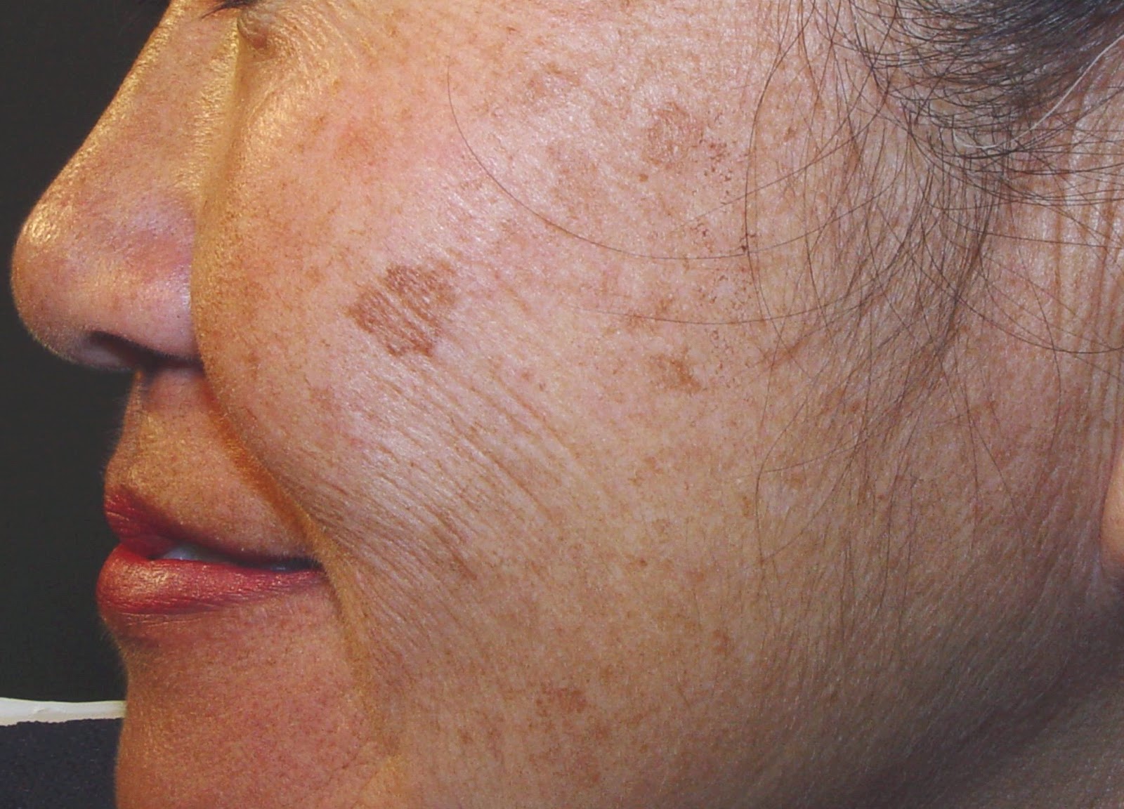 skin-by-celeste
