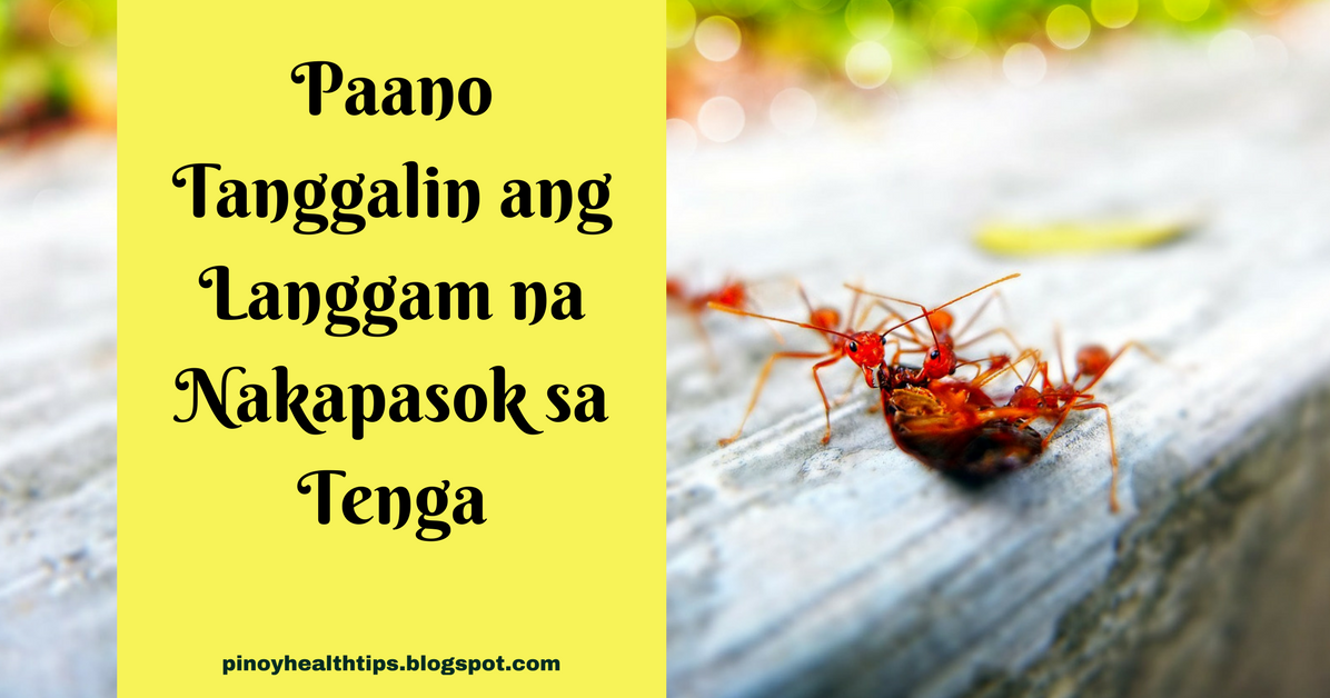 Paano Tanggalin ang Langgam na Nakapasok sa Tenga
