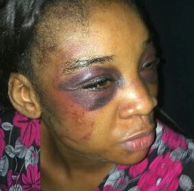 IMG 20161227 WA0006 Exclusive photos: Husband beats and stabs his wife in her private part after accusing her of cheating