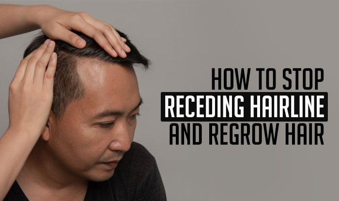 How to Stop Receding Hairline and regrow hair