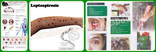 Cara Mengobati Asam Urat Cara mengobati Leptospirosis Cara Mengobati Asam Urat Cara mengobati Leptospirosis