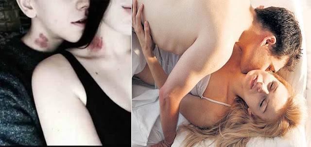 पुरुषों को क्यों पसंद है रोमांस के समय लवबाइट करना? - Romance time Love bite पुरुषों को क्यों पसंद है रोमांस के समय लवबाइट करना? - Romance time Love bite