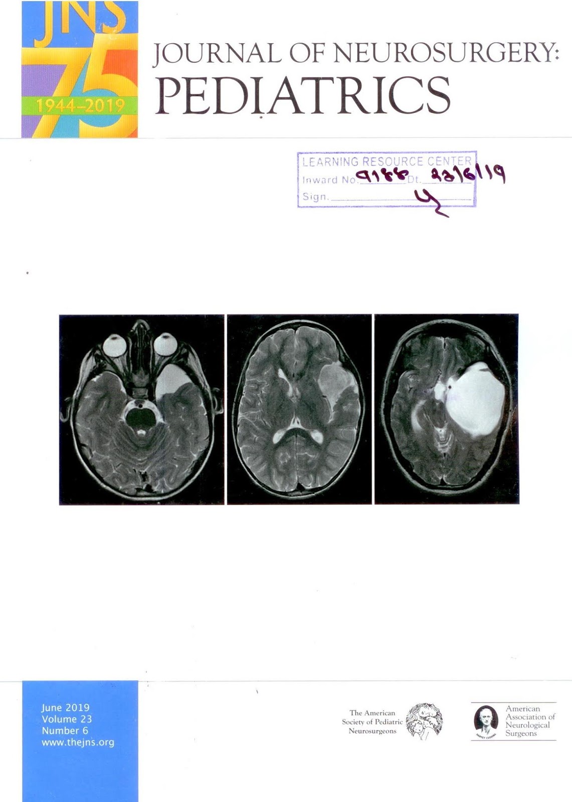 https://thejns.org/pediatrics/abstract/journals/j-neurosurg-pediatr/23/6/j-neurosurg-pediatr.23.issue-6.xml