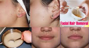 Facial hair problms in woman foto 409